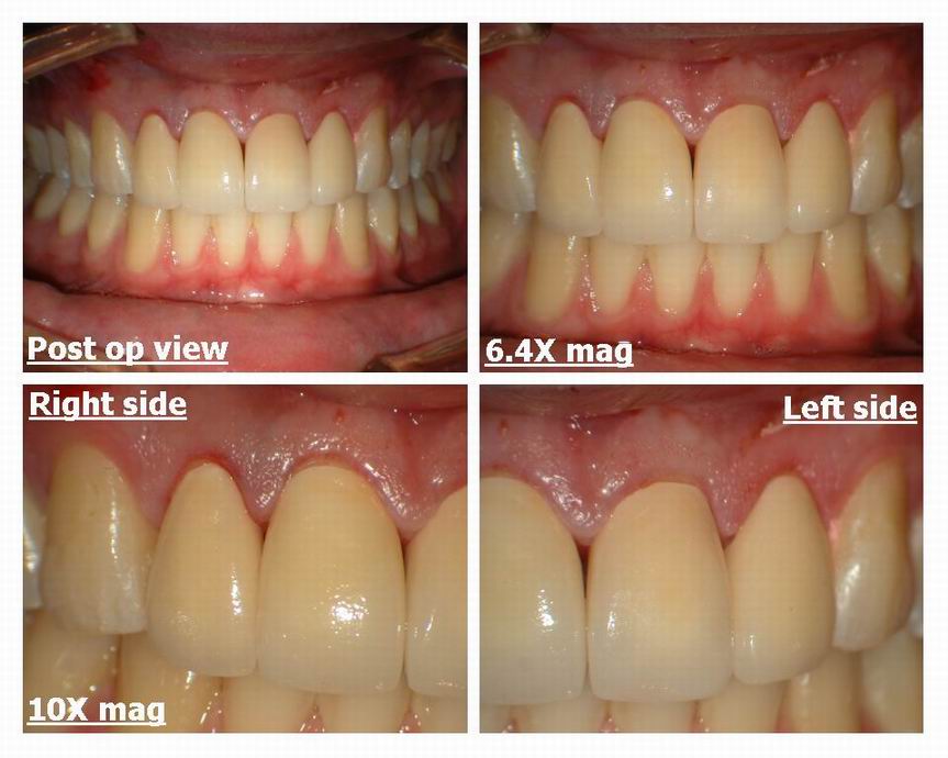 Resize of Crown insertion Derek Delong pg 3.jpg